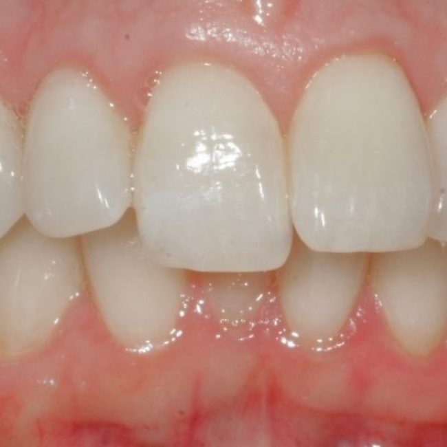 Orthodontics