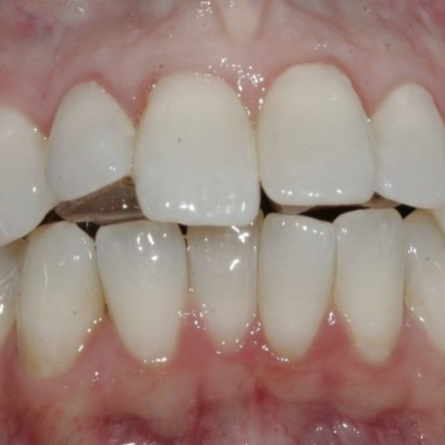 Orthodontics