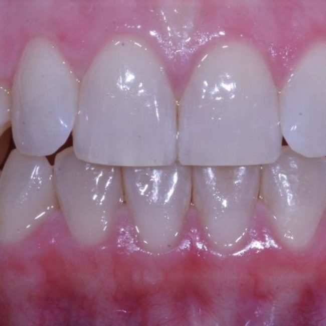 Orthodontics