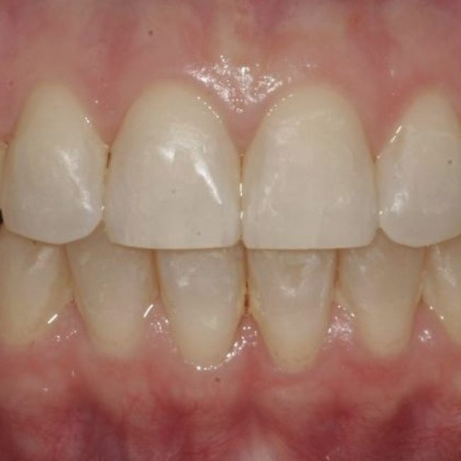 Orthodontics