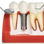 Benyammi Family Dentistry, Mountain View CA