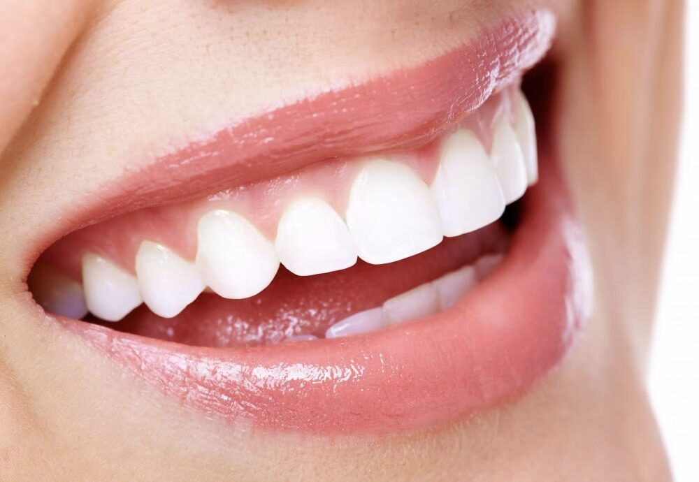 veneers mt. view dentist